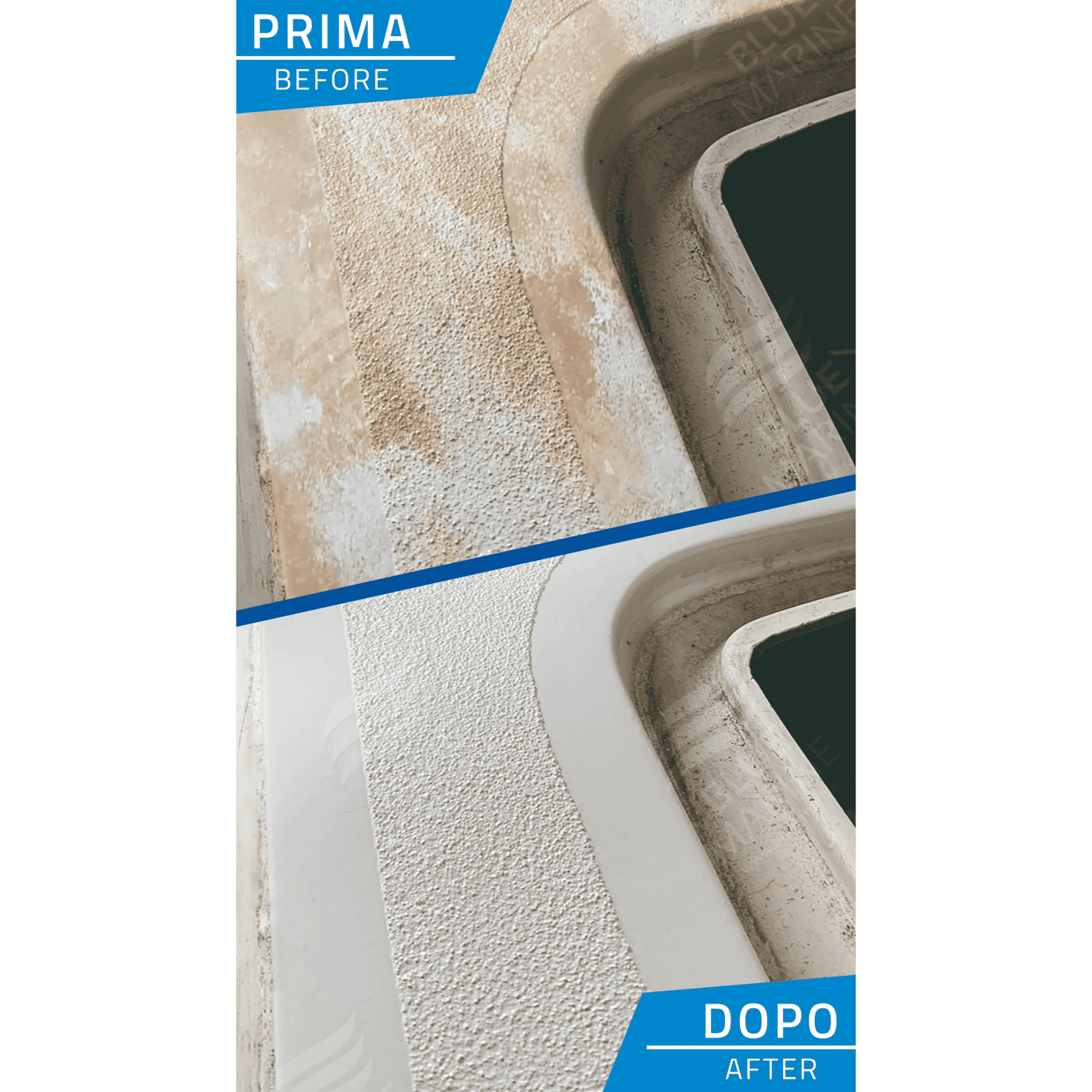 Before After Laser Liquidio Blue Marine 